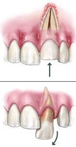 dental-trauma