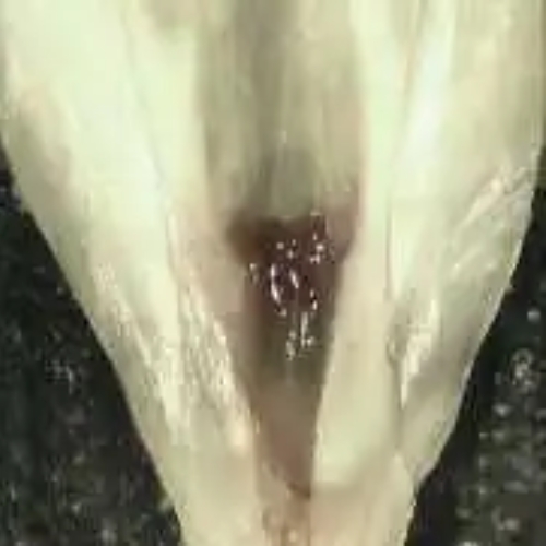Advanced Endodontics_GW Standard Treatment